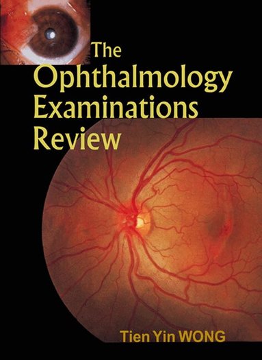 Tien Yin Wong - OPHTHALMOLOGY EXAMINATIONS REVIEW, THE, Inbunden