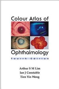 bokomslag Colour Atlas of Ophthalmology (Fourth Edition)