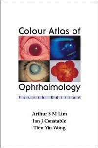 bokomslag Colour Atlas of Ophthalmology (Fourth Edition)