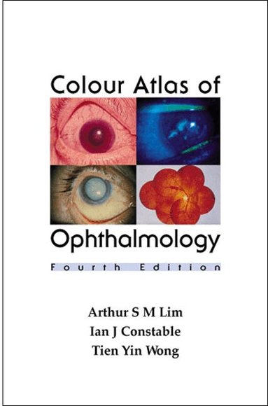 Siew Ming Lim, Arthur, Ian J Constable - COLOUR ATLAS OF OPHTHALMOLOGY (FOURTH EDITION), Häftad