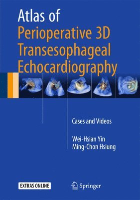 bokomslag Atlas of Perioperative 3D Transesophageal Echocardiography