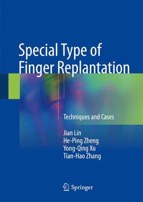 bokomslag Special Type of Finger Replantation