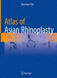 bokomslag Atlas of Asian Rhinoplasty