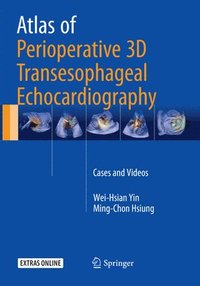 bokomslag Atlas of Perioperative 3D Transesophageal Echocardiography