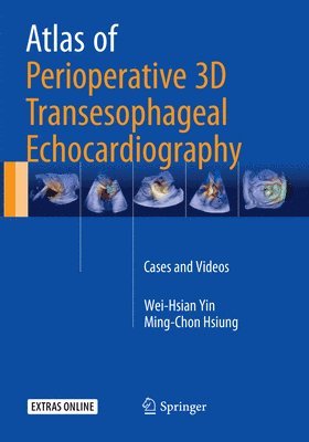 bokomslag Atlas of Perioperative 3D Transesophageal Echocardiography