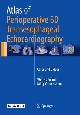 Atlas of Perioperative 3D Transesophageal Echocardiography 1