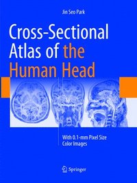 bokomslag Cross-Sectional Atlas of the Human Head