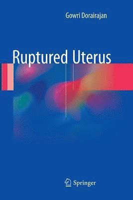 bokomslag Ruptured Uterus