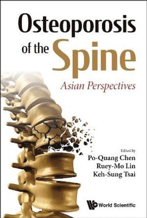 bokomslag Osteoporosis Of The Spine: Asian Perspectives