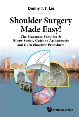 Shoulder Surgery Made Easy!: The Singapore Shoulder & Elbow Society Guide To Arthroscopic And Open Shoulder Procedures 1