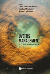 bokomslag Uveitis Management: A Clinical Handbook