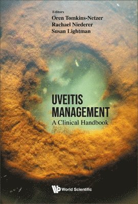 Uveitis Management: A Clinical Handbook 1