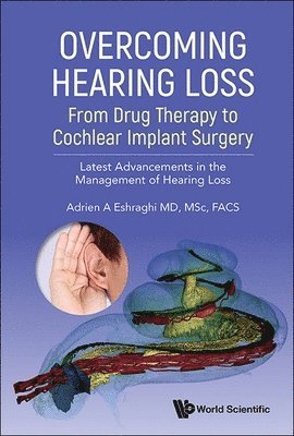 bokomslag Overcoming Hearing Loss: From Drug Therapy To Cochlear Implant Surgery - Latest Advancements In The Management Of Hearing Loss