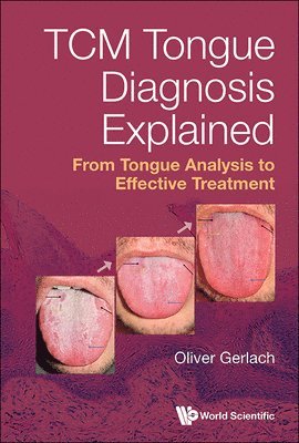 bokomslag Tcm Tongue Diagnosis Explained: From Tongue Analysis To Effective Treatment