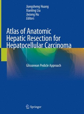 Atlas of Anatomic Hepatic Resection for Hepatocellular Carcinoma 1