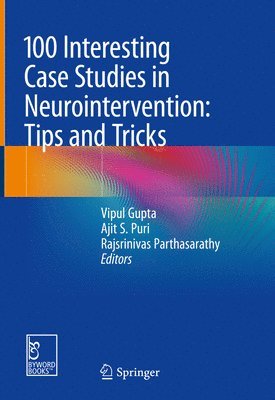 100 Interesting Case Studies in Neurointervention: Tips and Tricks 1
