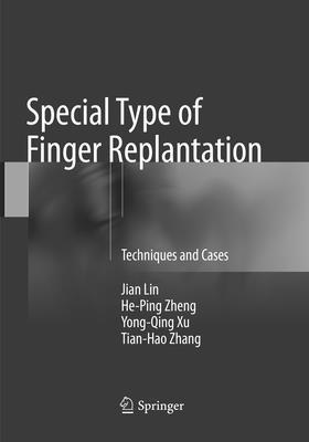 Jian Lin, He-Ping Zheng, Yong-Qing Xu, Tian-Hao Zhang - Special Type of Finger Replantation, Häftad