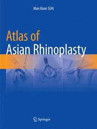 bokomslag Atlas of Asian Rhinoplasty