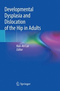 bokomslag Developmental Dysplasia and Dislocation of the Hip in Adults
