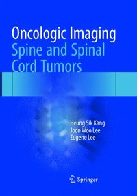 bokomslag Oncologic Imaging: Spine and Spinal Cord Tumors