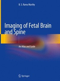 bokomslag Imaging of Fetal Brain and Spine