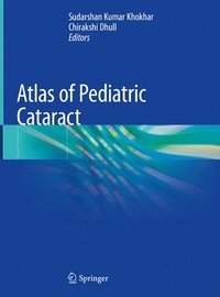 bokomslag Atlas of Pediatric Cataract