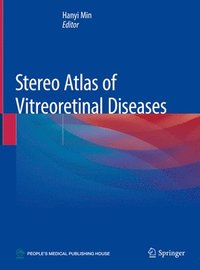 bokomslag Stereo Atlas of Vitreoretinal Diseases