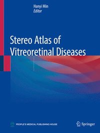 bokomslag Stereo Atlas of Vitreoretinal Diseases