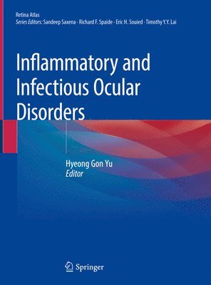 Inflammatory and Infectious Ocular Disorders