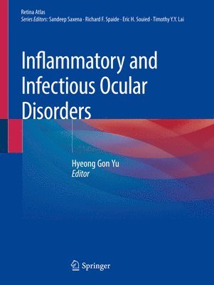 bokomslag Inflammatory and Infectious Ocular Disorders