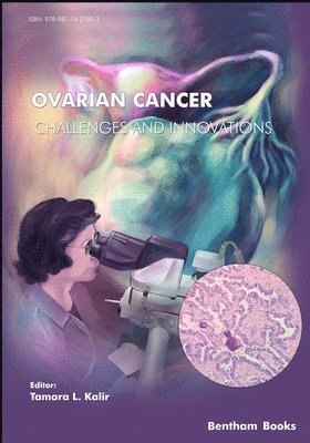 bokomslag Ovarian Cancer - Challenges & Innovations