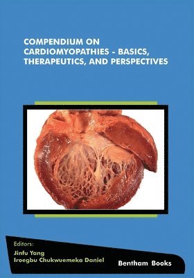 bokomslag Compendium on Cardiomyopathies - Basics, Therapeutics, and Perspectives