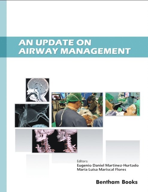 An Update on Airway Management 1