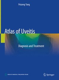 bokomslag Atlas of Uveitis