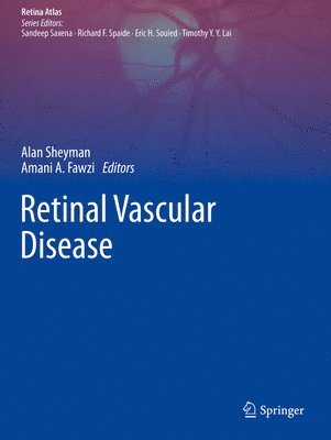 bokomslag Retinal Vascular Disease