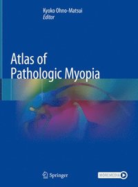 bokomslag Atlas of Pathologic Myopia