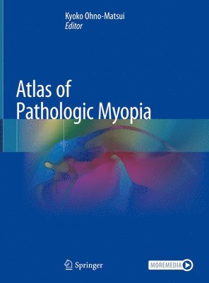 bokomslag Atlas of Pathologic Myopia