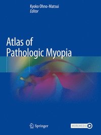 bokomslag Atlas of Pathologic Myopia