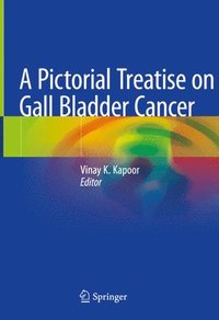 bokomslag A Pictorial Treatise on Gall Bladder Cancer