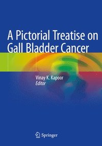 bokomslag A Pictorial Treatise on Gall Bladder Cancer