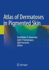 bokomslag Atlas of Dermatoses in Pigmented Skin