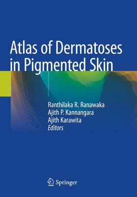 Ranthilaka R. Ranawaka, Ajith P. Kannangara, Ajith Karawita - Atlas of Dermatoses in Pigmented Skin, Häftad