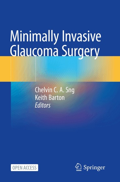 Chelvin C. A. Sng, Keith Barton - Minimally Invasive Glaucoma Surgery, Häftad