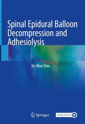 Spinal Epidural Balloon Decompression and Adhesiolysis 1