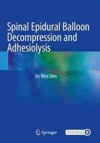 bokomslag Spinal Epidural Balloon Decompression and Adhesiolysis