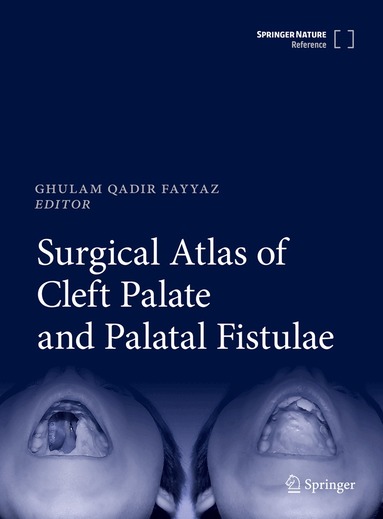 Ghulam Qadir Fayyaz - Surgical Atlas of Cleft Palate and Palatal Fistulae, Inbunden
