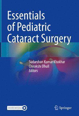 Sudarshan Kumar Khokhar, Chirakshi Dhull - Essentials of Pediatric Cataract Surgery, Inbunden