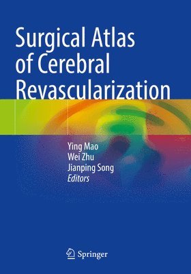 Ying Mao, Wei Zhu, Jianping Song - Surgical Atlas of Cerebral Revascularization, Häftad