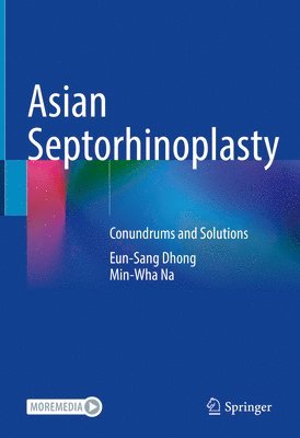 bokomslag Asian Septorhinoplasty