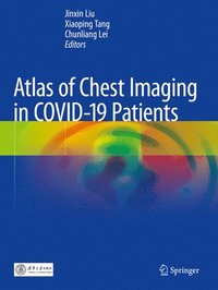 bokomslag Atlas of Chest Imaging in COVID-19 Patients